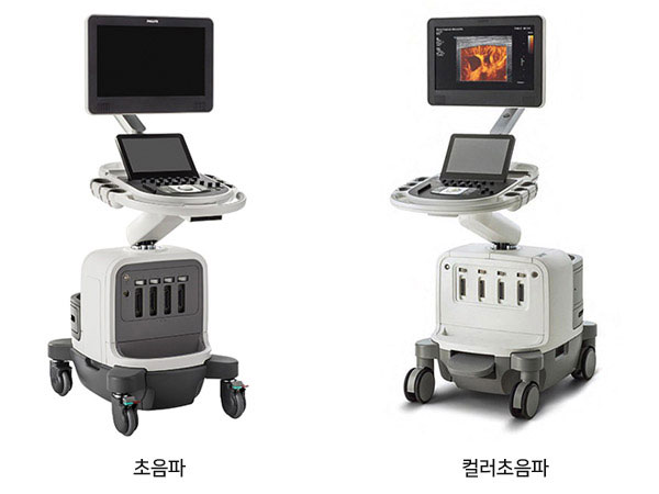 초음파 진단기