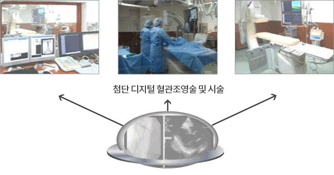 첨단 디지털 혈관조영술 및 시술