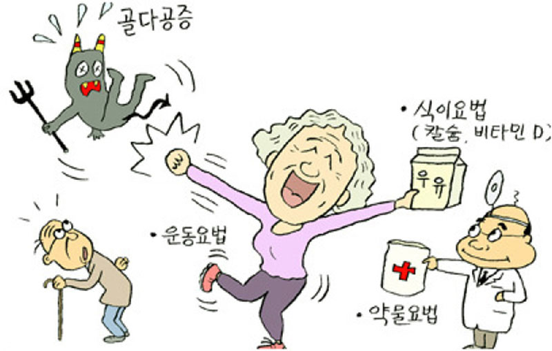 골다공증 사진