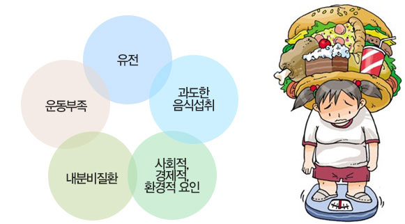 소아비만의 원인