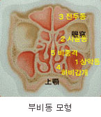 부비동 모형