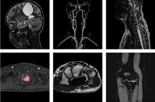 MRI