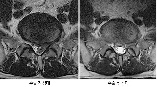 수술적치료 사진