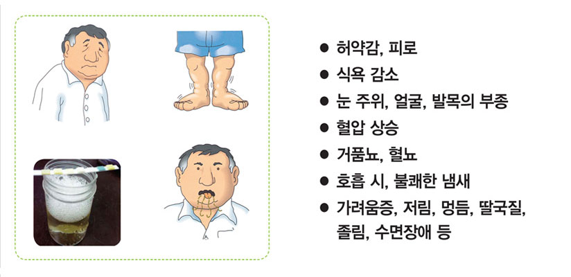 만성콩팥병의 증상 사진